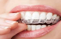 Силиконовые зубные протезы