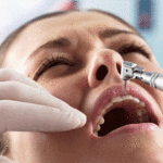 Стоматофобия