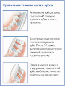 Техника чистки зубов