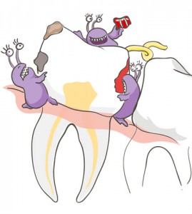 Бактерии на зубе Бактерии на зубе