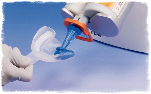 Слепок зубов при прямом методе изготовления виниров